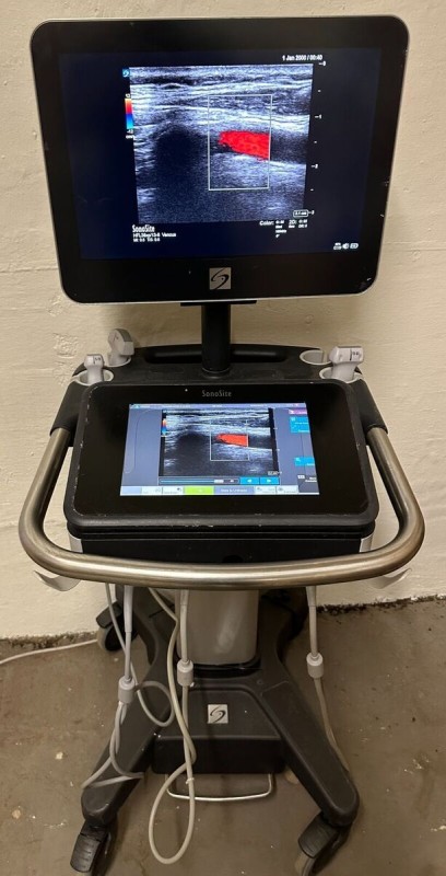 SonoSite X-Porte Portable Ultrasound System with Cart